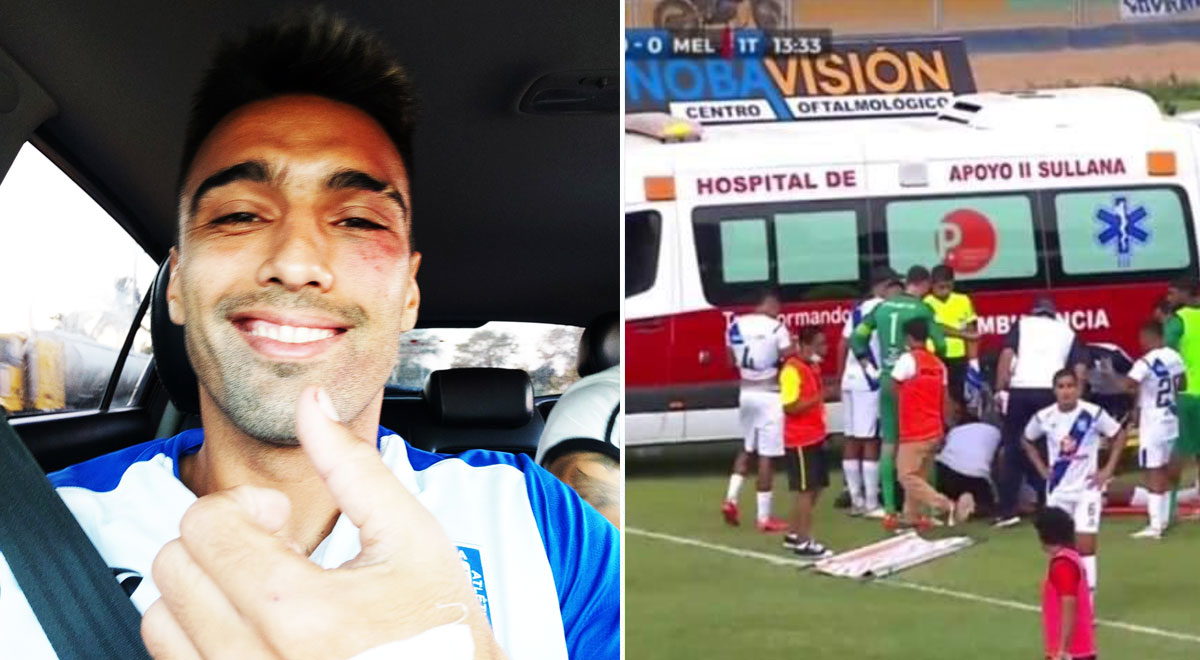 Adrián Fernández tras quedar inconsciente en el Melgar vs. Sullana: 