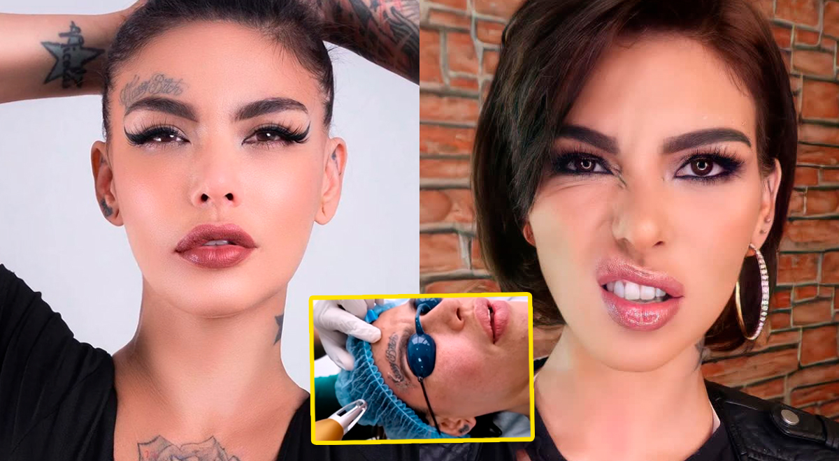 Angie Jibaja se borra todos sus tatuajes: 