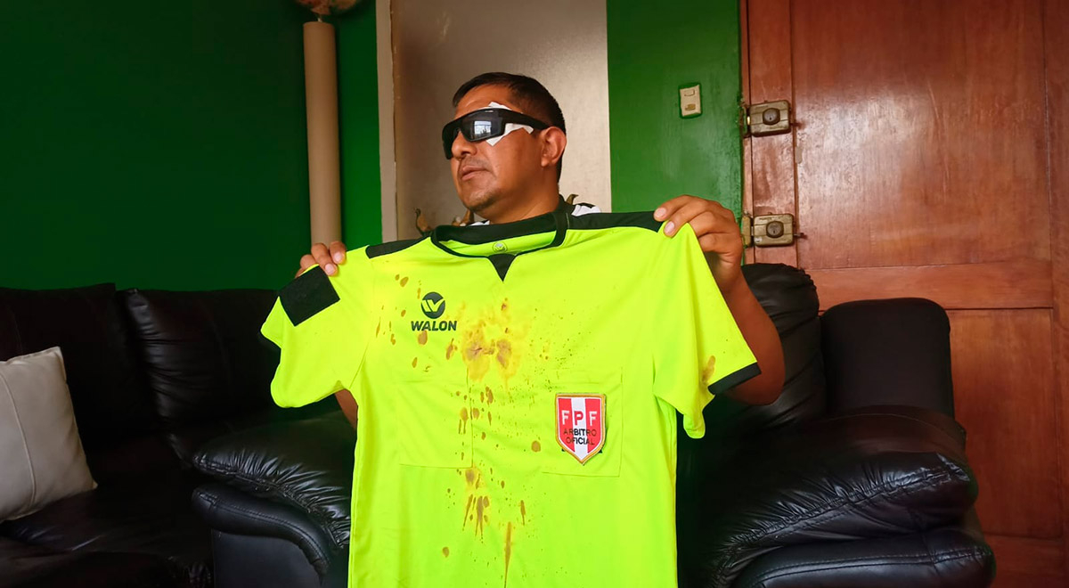 Árbitro de Copa Perú perdió la vista tras brutal agresión en Cusco 