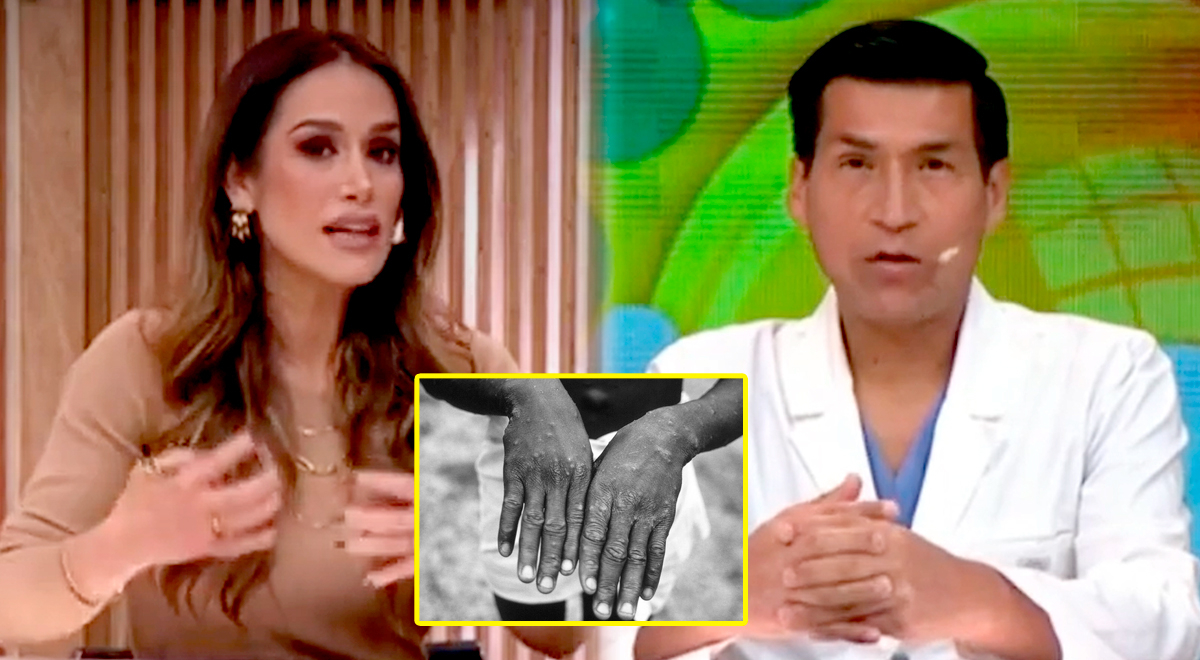Karina Borrero confronta a médico que recomienda abstinencia entre varones por viruela del mono