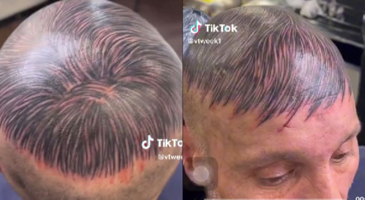 Hombre se tatúa en la cabeza para disimular calvicie: 