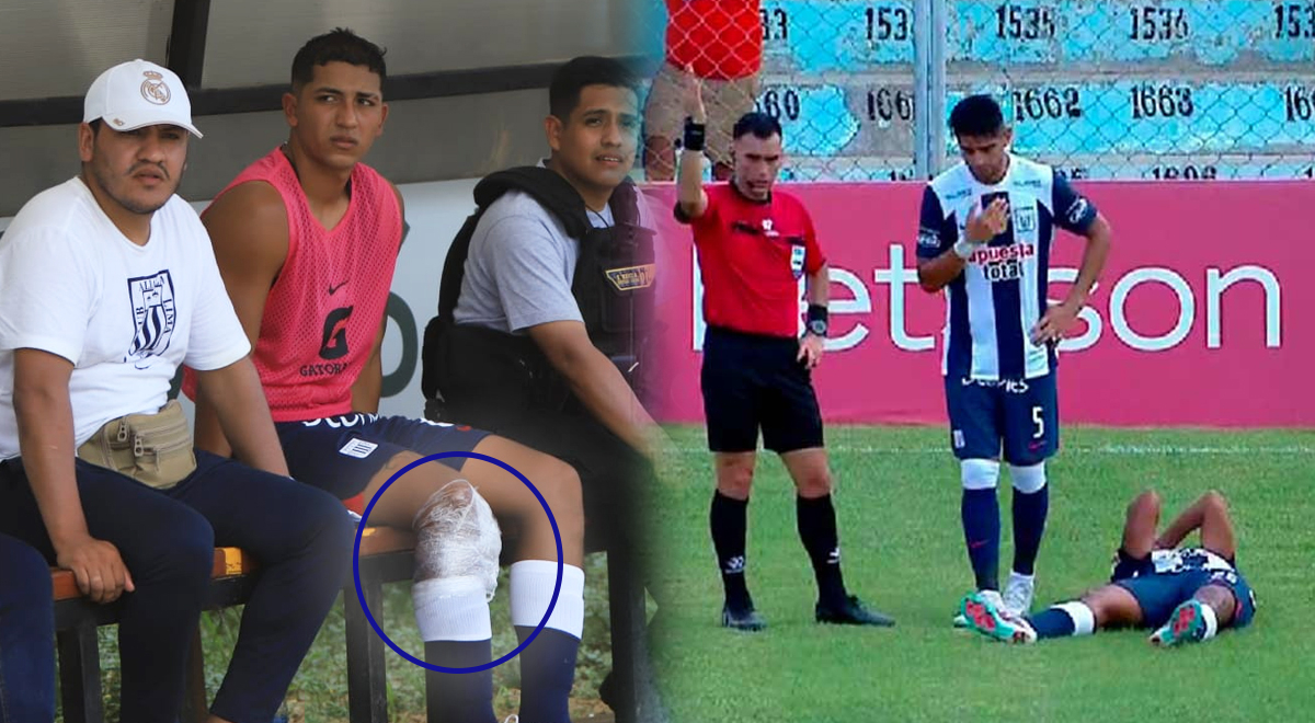 Is Montoya's injury serious? Alianza's defender couldn't walk to the locker room.