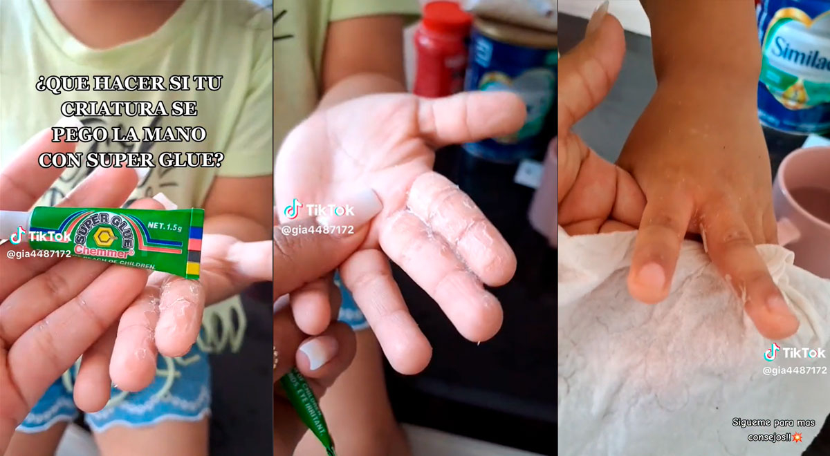 ¿Qué hacer si tu hijo se pegó la mano con Super Glue?: conoce el infalible truco
