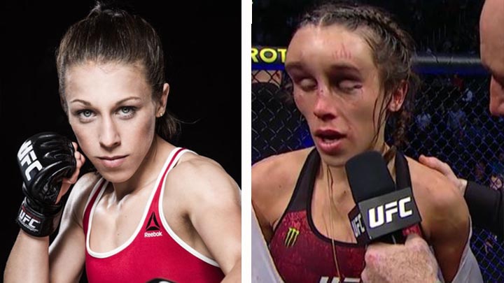 Ufc Joanna Jedrzejczyk Termin Con El Rostro Desfigurado Tras